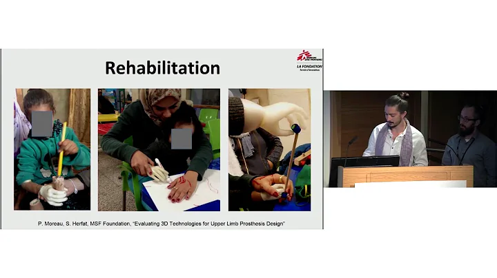 Evaluating 3D technologies for upper limb prosthesis design, Amman, Jordan