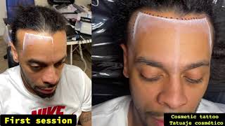 Smp Scalp Micropigmentation Orlando
