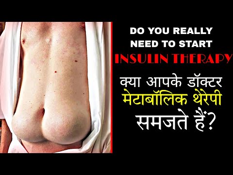 Complication Of Longterm Insulin Therapy || Fully Explained In HINDI By Metabolic Dr.K