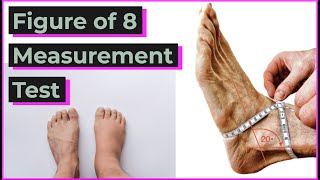 Figure of 8 Measurement Test | Post Op Ankle Swelling