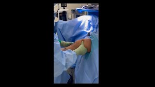 ACL Stability Pre and Post Surgery - 14 Year Old Female Skeletally Mature Soccer Athlete