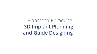 3D Implant Planning and Guide Designing in Planmeca Romexis screenshot 2