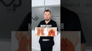 Где находятся швы после платизмопластики?☝🏻 Рассказываем в видео