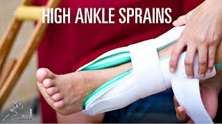 High ankle sprain: Signs, symptoms and treatment of a syndesmosis injury