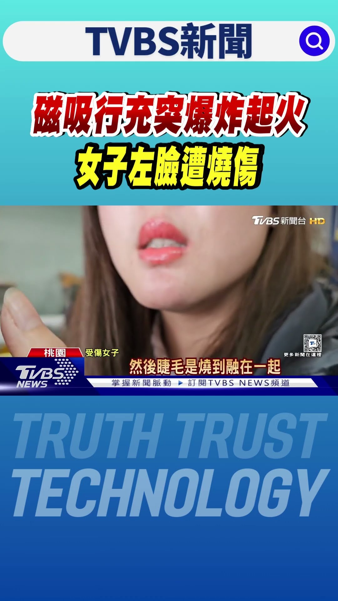 磁吸行充突爆炸起火 女子左臉遭燒傷｜TVBS新聞 @TVBSNEWS01