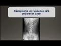 Radiologie  1er cours  asp 1re partie