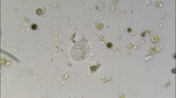 cilliate rotating in compost extract at 400x