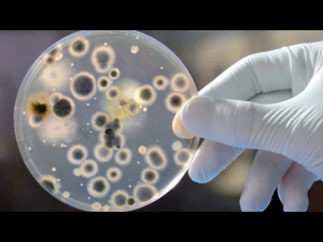 Плесень - эволюция и классификация. Рассказывает биолог Визма Николаева