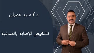 تشخيص الإصابة بالصدفية