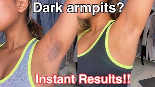 How To Get Rid Of Dark Armpits INSTANTLY! 100% works screenshot 2