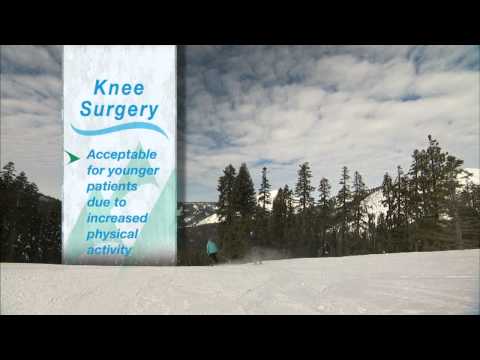 Knee Replacement with