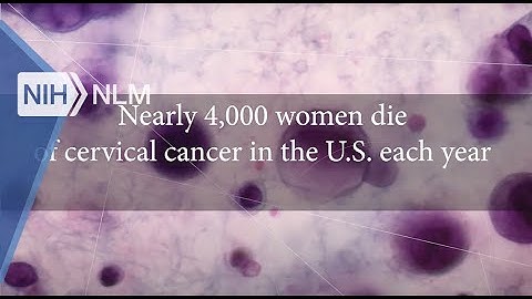 Cervical Cancer Screening