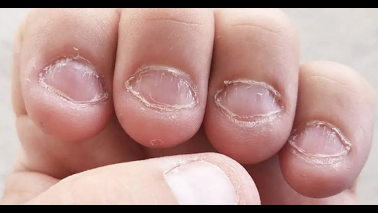 1. "Nude shades for bitten nails" - wide 1