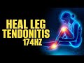 Heal Leg Tendonitis | Get Relief from Leg Muscles Pain | Speed Recovery | 174hz Pain Relief