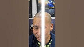 Hình ảnh sau xăm tóc sử dụng thuốc tê #xămtóc #reviewxămtóc  vnscalp #xămtóc #scalp #reviewxămtóc