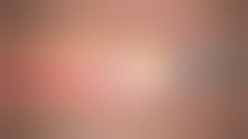 Stratafix Symmetric PDS Plus Video