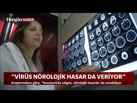 "Virüs nörolojik hasar da veriyor"