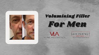 Volumizing Filler on Man | Skin Perfect Walnut Medical Spa Clinic