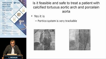 L. Michalis | The PORTICO TAVR system. Program Update, clinical data.
