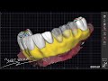 خدمة تثبيت برامج مختبر الأسنان | Exocad 3Shape CEREC Ceramill
