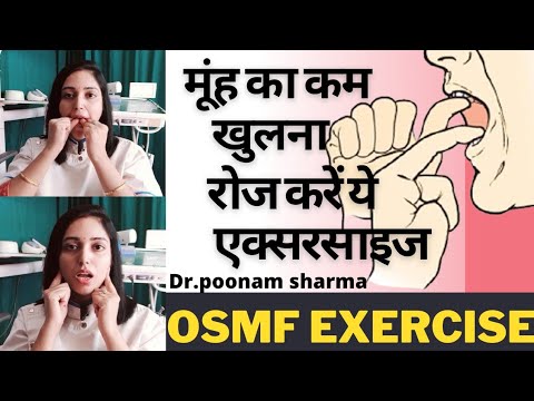 मुंह का कम खुलना रोज करें यह Exercise ||OSMF Exercises || Less Mouth Opening Exercises||