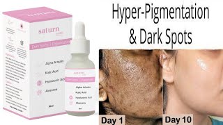 Saturn By GHC Dark Spots &amp; Pigmentation Serum 😮😮 || 💯% Result  || Beauty With Easy Tips