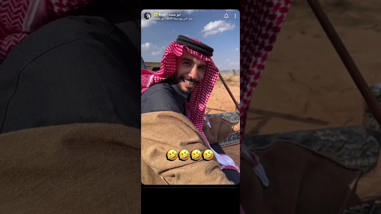 #ابوحصه #ابوعجيب | هذا مافعلته قدمك 😅