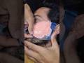 Beard Removing Video | Beard Growth Video #shorts #viral #barber #hairstyle