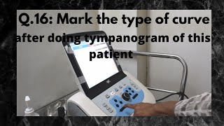 043. Impedance Audiometry; Tympanogram & Acoustic Reflex  #audiology  #osce