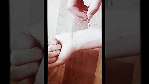 يد مجروحه بالموس حقيقيه Mp3