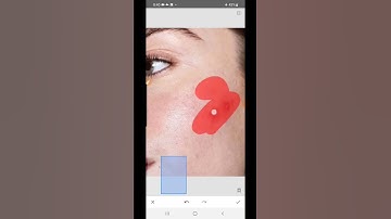 How to remove pimples by Snapseed editing||#snapseed #shorts #edit