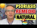 ✋ PSORIASIS 👉 ¿QUÉ ES? ❤️ REMEDIOS NATURALES ❤️