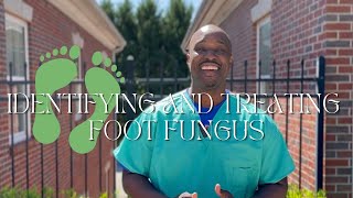 Do I Have a Fungal Infection?! How To Treat It👣