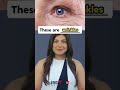 Do you know these words Skin Problems Vocabulary Follow english ingeneral, #learntopodcast