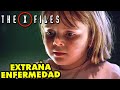 Nació Con BERRUGA Cancerosa Que MATA al Explotarla - Resumen X-FILES o Expedientes X