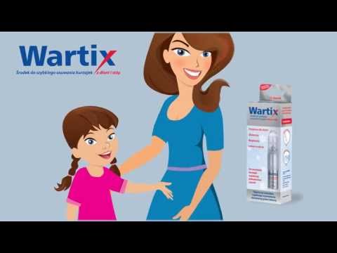 Video: Wartix