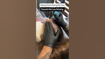 Scalp Micropigmentation in Edmonton Alberta Canada