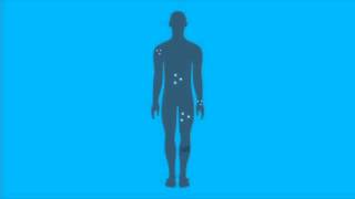 Quell Wearable Pain Relief Technology on QVC