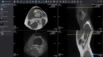 Introduction to the AlemHealth DICOM Viewer