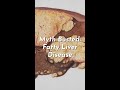 Myth Busted: Fatty Liver Disease