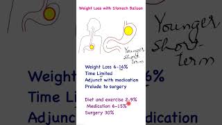 Stomach Balloon for Weight Loss