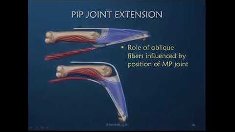 Obstinate PIP Joint: Part 3 of 12: Drivers of PIP Joint Extension