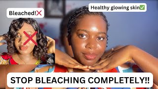 HOW TO SAFELY STOP BLEACHING YOUR SKIN AND REPAIR BLEACHED SKIN