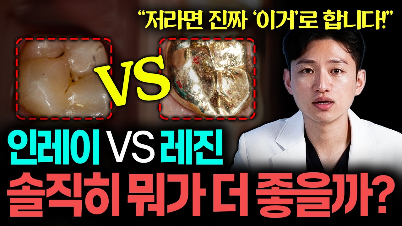 “요즘 충치 치료는 이겁니다” | 충치로 치과 가기 전에 제발 보세요 | (모르면 돈 날림;;;)