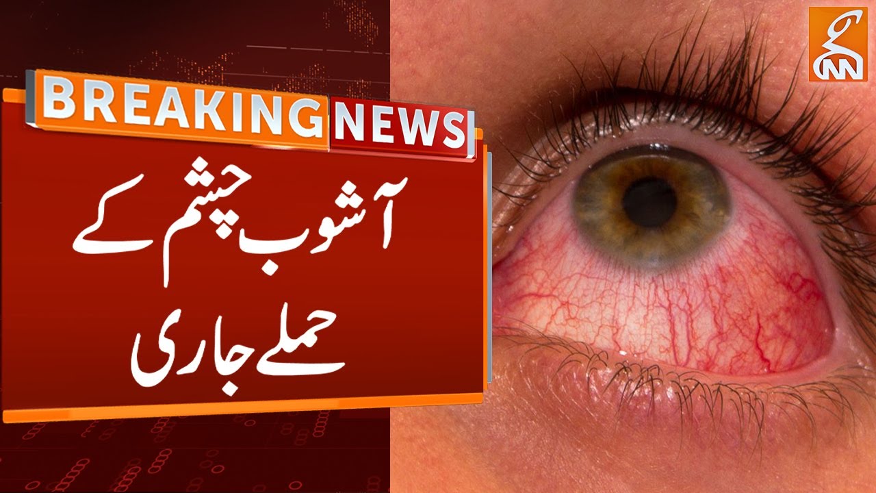 Big News on Eyes Infection In Pakistan Eye Infection Cases Breaking