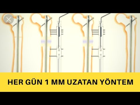 Video: Bir ödeme Nasıl Uzatılır