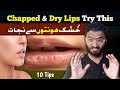 Chapped Lips in Winter | 10 Simple Tips to Cure Cracked or Dry Lips in Urdu/Hindi