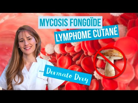 Mycosis fungoides: a lymphoma in the skin, what is it? Answers by @DermatoDrey