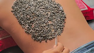 LIVE🔴...Relaxing Seeds Removal (Sunflowers Seeds) Painless √