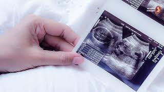 أعراض تشعر بها الحامل تؤكد للأم الحامل على توقف نبض الجنين